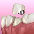 DentoSmiles