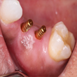 DentoSmiles