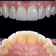 DentoSmiles